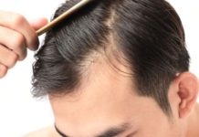 Hair fall